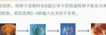 2026吉林省精子存储医院医院名录，试管婴儿费用与程序指南