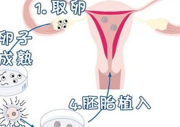 2026四川最大的比较好的助孕公司，这三家都是不错的选择